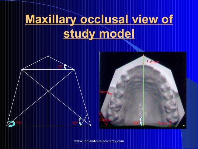 maxillary be a trimmed will model Study by models courses orthodontic fixed /certified