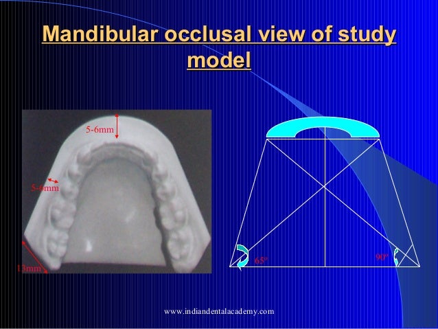 trimmed be will maxillary model a Study courses fixed by orthodontic models /certified