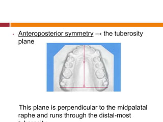 • Anteroposterior symmetry → the tuberosity
plane
This plane is perpendicular to the midpalatal
raphe and runs through the distal-most
 