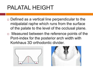 PALATAL HEIGHT
 Defined as a vertical line perpendicular to the
midpalatal raphe which runs from the surface
of the palate to the level of the occlusal plane.
 Measured between the reference points of the
Pont-index for the posterior arch width with
Korkhaus 3D orthodontic divider.
 