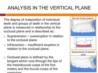 ANALYSIS IN THE VERTICAL PLANE
The degree of malposition of individual
teeth and groups of teeth in the vertical
plane is measured in relationship to the
occlusal plane and is described as:
 Supraversion – overeruption in relation
to the occlusal plane
 Infraversion – insufficient eruption in
relation to the occlusal plane.
 Occlusal plane is defined by the
tangent which runs through the tips of
the mesiobuccal cusps of the first
molars and the buccal cusps of the
Normal incisor postion
Supraversion of anterior
teeth
 