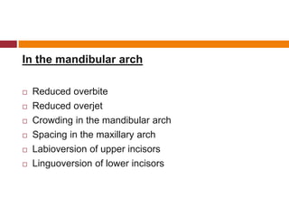 In the mandibular arch
 Reduced overbite
 Reduced overjet
 Crowding in the mandibular arch
 Spacing in the maxillary arch
 Labioversion of upper incisors
 Linguoversion of lower incisors
 