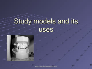 Study models and itsStudy models and its
usesuses
www.indiandentalacademy.comwww.indiandentalacademy.com
 