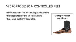 STUDY OF PROSTHETIC FEET AND SHOE MODIFICATIONS[1].pptx