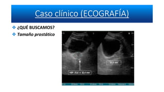 ❖ ¿QUÉ BUSCAMOS?
❖ Tamaño prostático
 