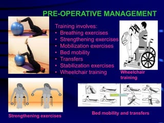 Stump Care.pdf Amputation,Stump care, phantom limb pain and gait training in lower ...