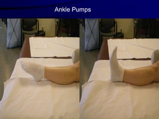 Stump Care.pdf Amputation,Stump care, phantom limb pain and gait training in lower ...