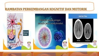 HAMBATAN PERKEMBANGAN KOGNITIF DAN MOTORIK
 