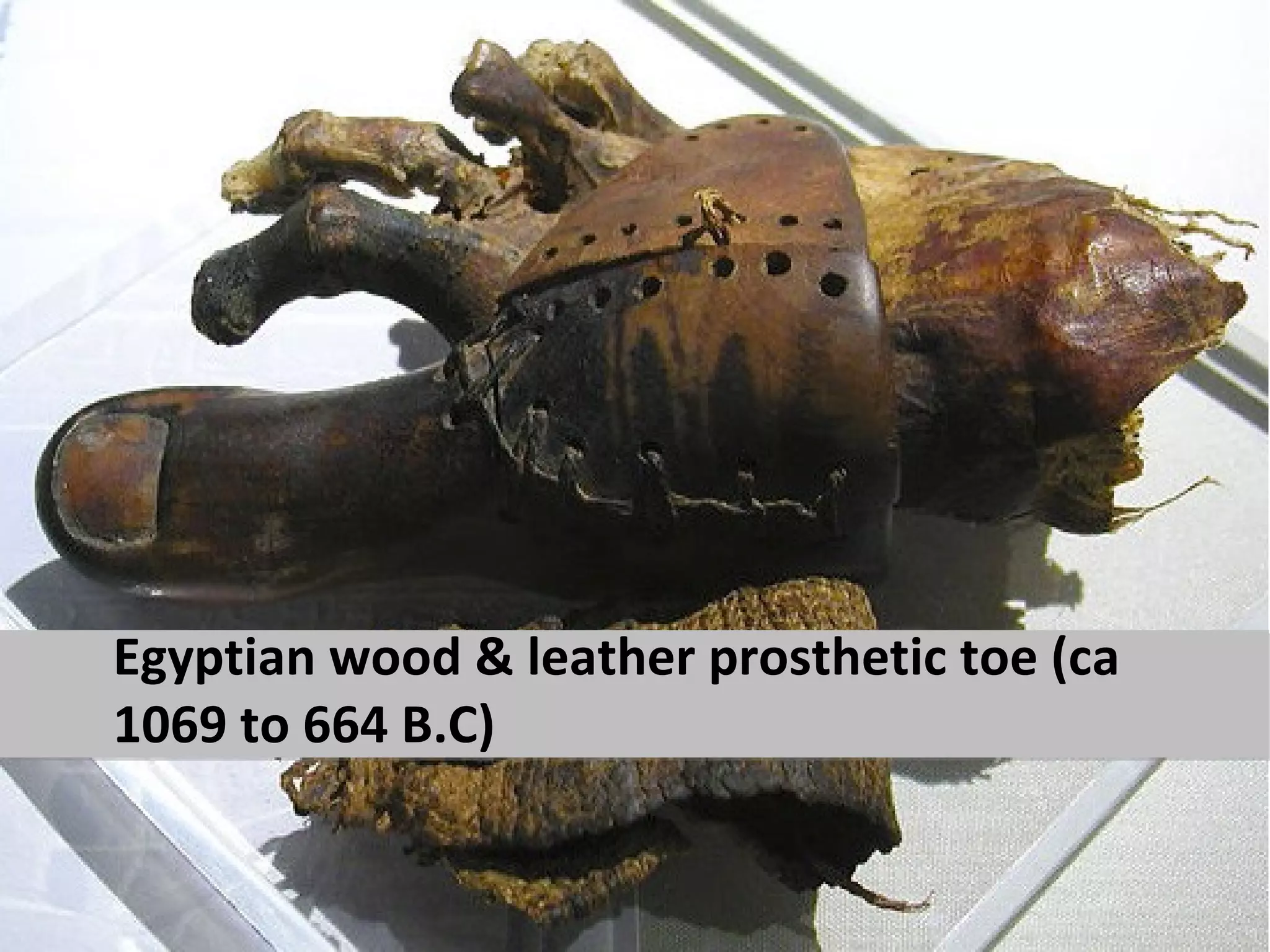 Egyptian wood & leather prosthetic toe (ca
1069 to 664 B.C)
 
