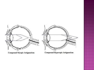 Sturms conoid | PPT