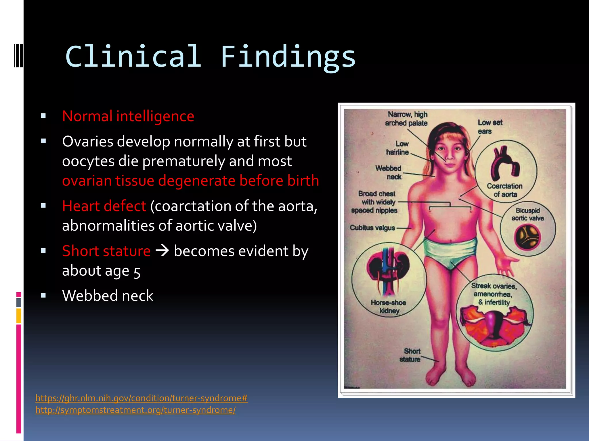 danny-kruger-syndrome-dunning-kruger-explication-lsbgb