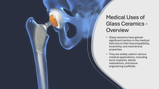 Medical Uses of
Glass Ceramics -
Overview
• Glass ceramics have gained
significant traction in the medical
field due to their biocompatibility,
bioactivity, and mechanical
properties.
• They are widely used in various
medical applications, including
bone implants, dental
restorations, and tissue
engineering scaffolds.
 