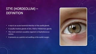 Sty Definition Comprehensive Overview of Stye, Chalazion, and Eye Foreign Bodies in ...