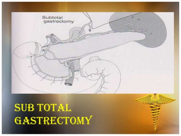 Fatty liver CT wikidoc