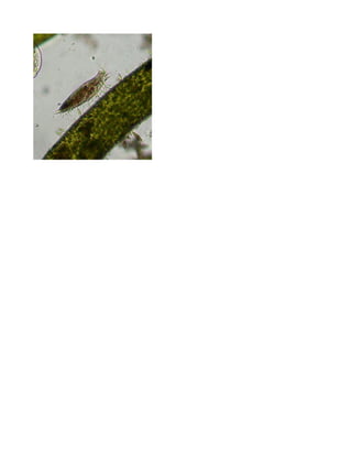 Nombre vulgar: 
Nombre científico: Stylonychia 
Reino: Protista 
Filo: Ciliophora 
Clase: Spirotrichea 
Descripción: 
En la zona adoral presentan típicamente cilios orales prominentes o membranelas bajo la forma de una serie 
de policinetias, que comienzan en la parte anterior de la cavidad bucal y terminan en el lado izquierdo de la 
boca. También pueden presentar una o dos membranas paorales en su lado derecho. En algunos, los cilios 
corporales se funden para formar policinetias llamados cirros, y en otros son escasos o están ausentes. 
Pueden llegar a medir entre 100 y 370 micras. 
Su color verde en la vacuola se debe a las algas que forman parte de su alimentación. 
Las formas con cirros son comunes en suelos, agua dulce y ambientes marinos. Tienden a ser aplanados, con 
los cirros confinados a la superficie ventral. Los cirros tienen diversos usos, tales como para arrastrarse sobre 
objetos, actuando como pies, para nadar o asistir en la captura del alimento. 
Son depredadores y atrapan a sus presas mediante torvellinos que generan sus cilios. 
A pesar de ser unicelulares, están compuestos por un sistema nervioso motor que coordina los movimientos de los 
cilios. 
Fuentes bibliográficas: 
http://treparriscosfieldnotebook.blogspot.com/2013/11/stylonychia-depredador-unicelular-de.html 
http://en.wikipedia.org/wiki/Stylonychia 
