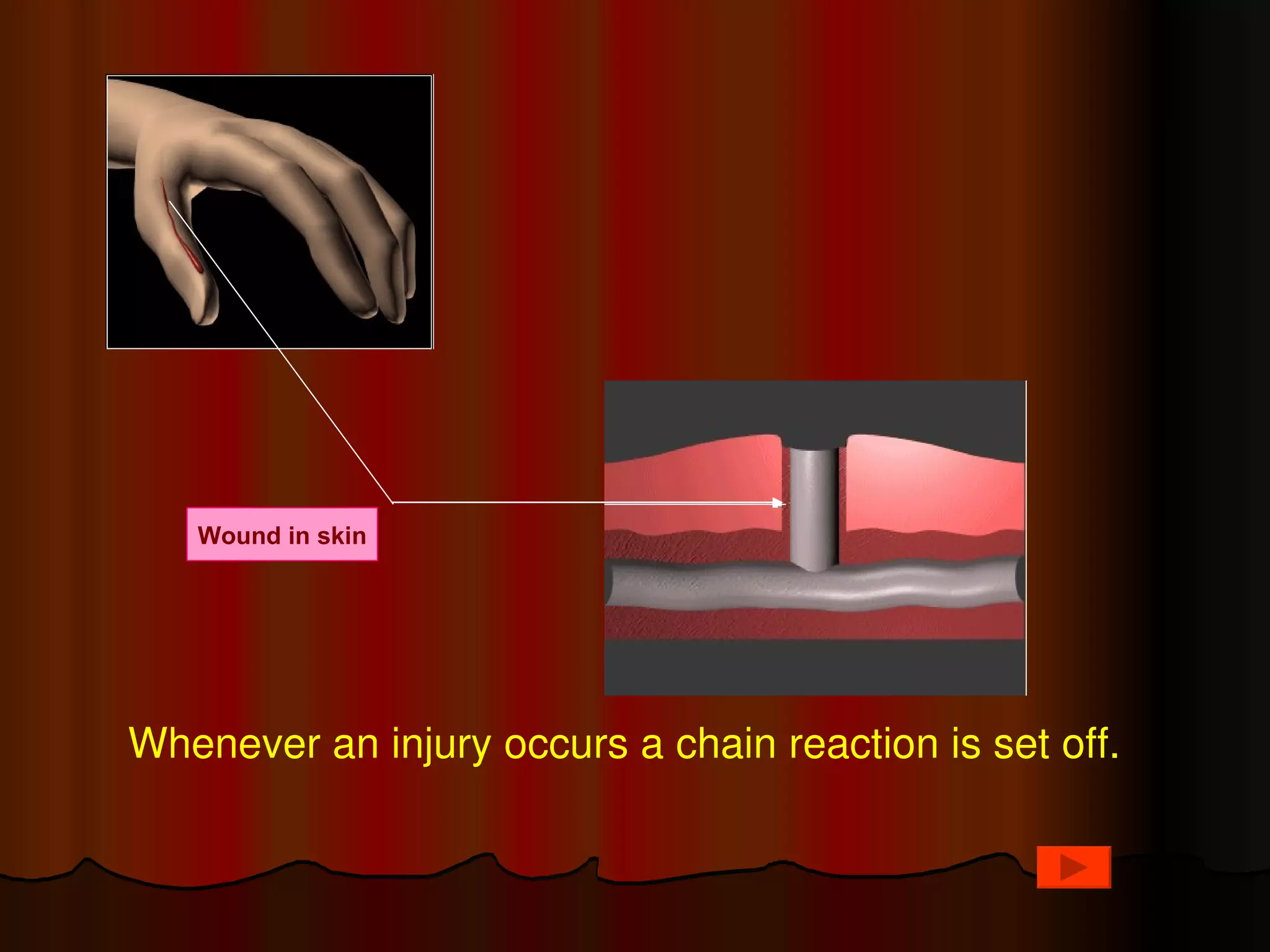 Wound in skin




Whenever an injury occurs a chain reaction is set off.
 