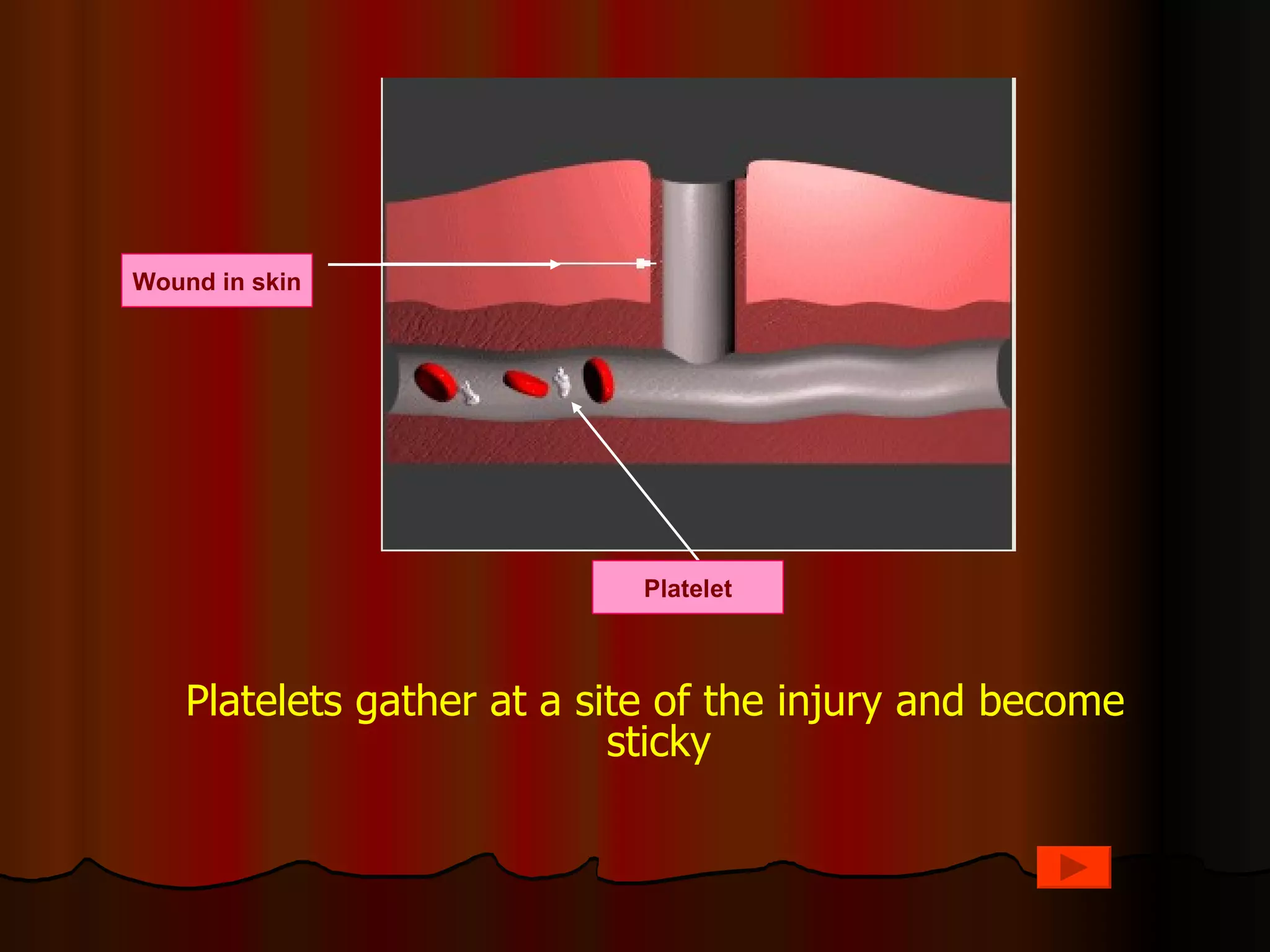 Wound in skin




                            Platelet



    Platelets gather at a site of the injury and become
                            sticky
 
