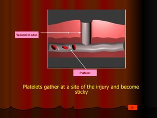 Wound in skin




                            Platelet



    Platelets gather at a site of the injury and become
                            sticky
 