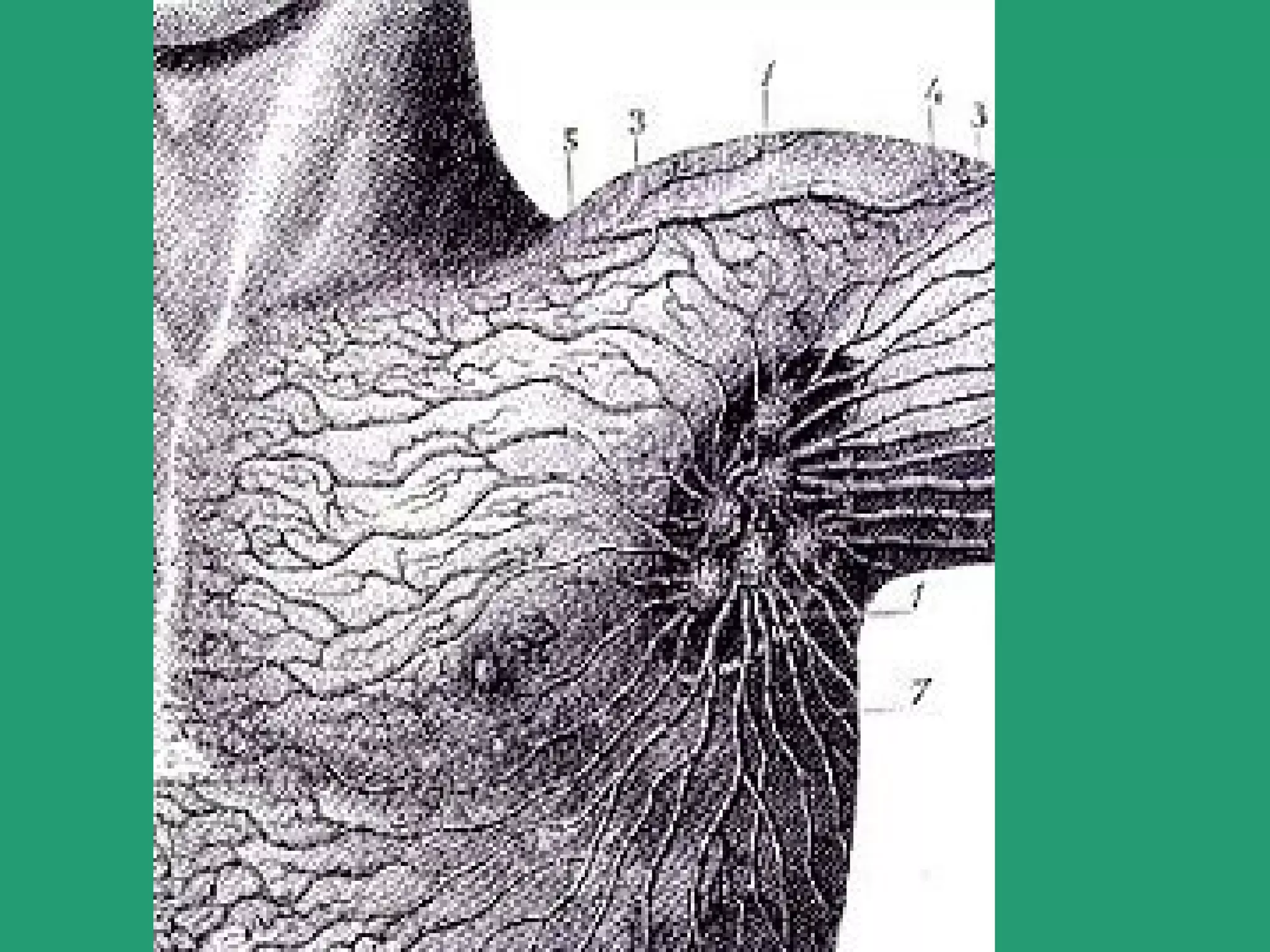 Sub 1[1].4   form 5 (part 1)