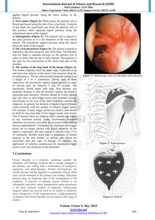 International Journal of Science and Research (IJSR)
ISSN (Online): 2319-7064
Index Copernicus Value (2013): 6.14 | Impact Factor (2013): 4.438
Volume 4 Issue 5, May 2015
www.ijsr.net
Licensed Under Creative Commons Attribution CC BY
applied digital pressure along the entire surface of the
deltoid.
3. Teres minor (Figure 4): While prone, the patient's arm is
flexed and braced along the side of his or her body. Using his
or her thigh, the practitioner can brace the patient's arm in
this position while applying digital pressure along the
inferolateral aspect of the scapula.
4. Infraspinatus (Figure 5): The patient's arm is placed in
the same position as it is for treatment of the teres minor
muscle. The practitioner applies pressure along the region
below the spine of the scapula.
5. The coracoid process (Figure 6): The patient is placed in
supination, the arms along the side of the body. The therapist
uses his thigh to maintain pressure on the patient's arm in
order to ensure that the arm is fully relaxed. This position is
the same for the examination of the whole front part of the
shoulder.
6. The tendon of the long head of the biceps (Figure 6):
The tendon originates from the upper edge of glenoid cavity
and transverse anterior to the head of the humerus along the
bicipital groove. TSs are often located along that tendon over
a length of 2 to 3 centimeters. During each of these
maneuvers, the practitioner applies digital pressure to areas
of elicited pain for between 5 and 15 seconds. The
practitioner should begin with light, firm pressure and
gradually increase it until the pressure reaches the patient's
maximum pain tolerance. Pressure should be evenly applied
and only once to each trigger point each treatment session.
Elicited pain to the area of the chief complaint confirms the
diagnosis. In general, the duration of applied digital pressure
varies inversely with the number of elicited trigger points.
For example, if many trigger points are elicited, each should
be held for less time than if few trigger points were found.
This is because there are limits to what a patient can endure
in any treatment session. Leahy recommends treatment
schedules not exceed every other day to permit tissue healing
between appointments. Treatments are continued until trigger
points are no longer elicited with digital palpation. In the
author's experience, this may require in chronic cases 15 to
30 treatments. Besides minor pain or tenderness of limited
duration in the area treated, no serious side effects are
associated with this type of therapy. In addition, the
application of ischemic compression for myofascial trigger
points is not very strenuous on the practioner.
7.Conclusions
Frozen shoulder is a common, sometimes painful, but
ultimately self limiting, condition that is usually managed in
the primary care setting with a combination of analgesics,
injections, and physiotherapy. Formal investigations are
usually normal, and the diagnosis is essentially clinical. Most
cases can be managed in the primary care setting. Educating
patients plays an important part in the management of the
condition. A minority of patients require referral to an
orthopaedic specialist, where manipulation under anaesthesia
is the most common method of treatment. Arthroscopic
surgical release has proved itself to be useful in refractory
cases. Irrespective of the treatment given, a high proportion
of patients with frozen shoulder do not regain a full range of
motion.
Figure 1: Arthroscope view of a shoulder with synovitis
Figure 2: Supraspinatus
Figure 3: Deltoid
Paper ID: SUB154410 1289
 