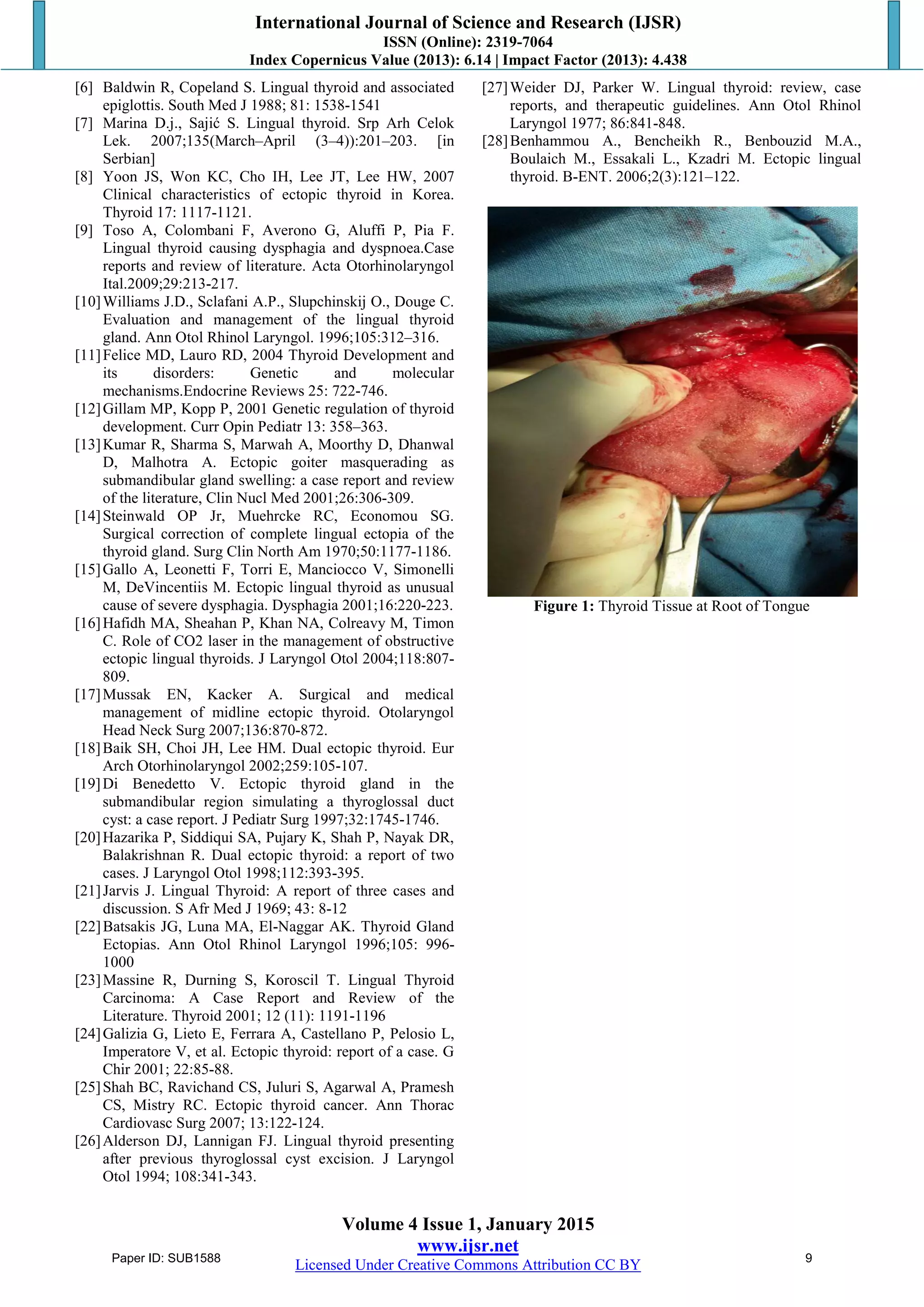 A Rare Case of Lingual Thyroid with Hypothyroidism | PDF