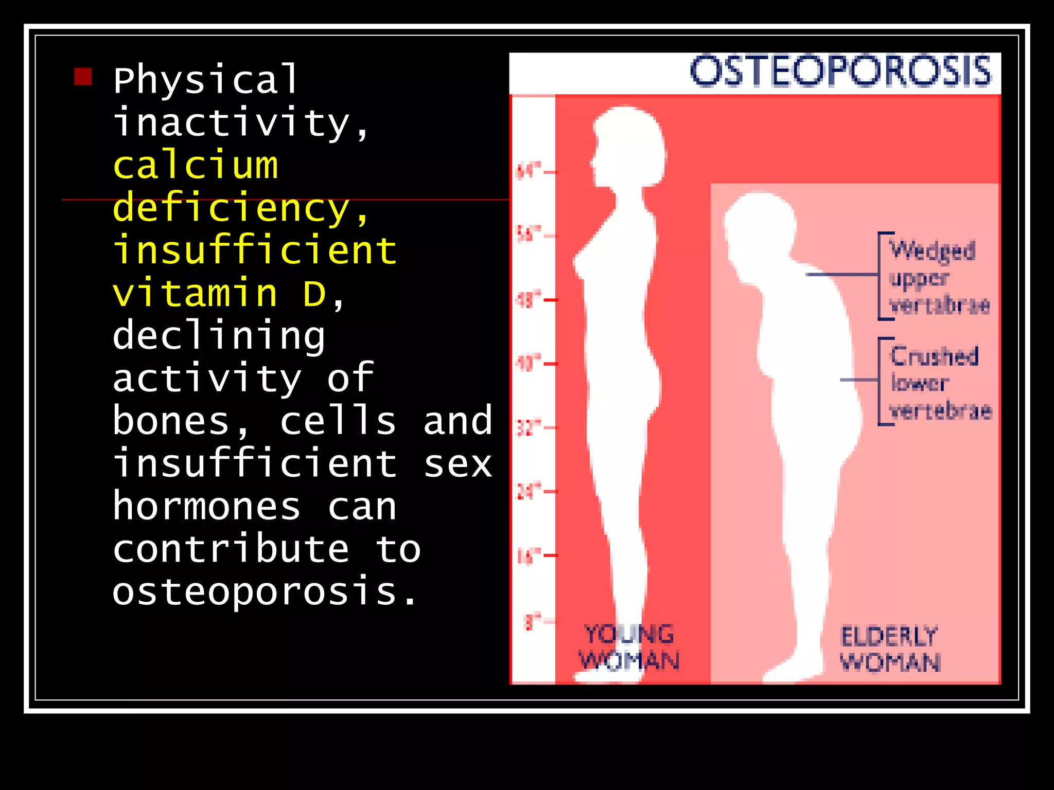    Physical
    inactivity,
    calcium
    deficiency,
    insufficient
    vitamin D,
    declining
    activity of
    bones, cells and
    insufficient sex
    hormones can
    contribute to
    osteoporosis.
 