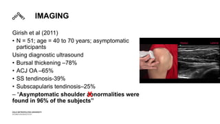 IMAGING
Girish et al (2011)
• N = 51; age = 40 to 70 years; asymptomatic
participants
Using diagnostic ultrasound
• Bursal thickening –78%
• ACJ OA –65%
• SS tendinosis-39%
• Subscapularis tendinosis–25%
– “Asymptomatic shoulder abnormalities were
found in 96% of the subjects”
X
 