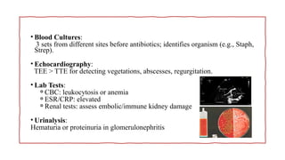 Comprehensive Overview of Subacute Infective Endocarditis: Diagnosis ...