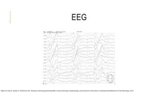 EEG
Mekki M, Eley B, Hardie D, Wilmshurst JM. Subacute sclerosing panencephalitis: clinical phenotype, epidemiology, and preventive interventions. Developmental Medicine & Child Neurology. 2019
 