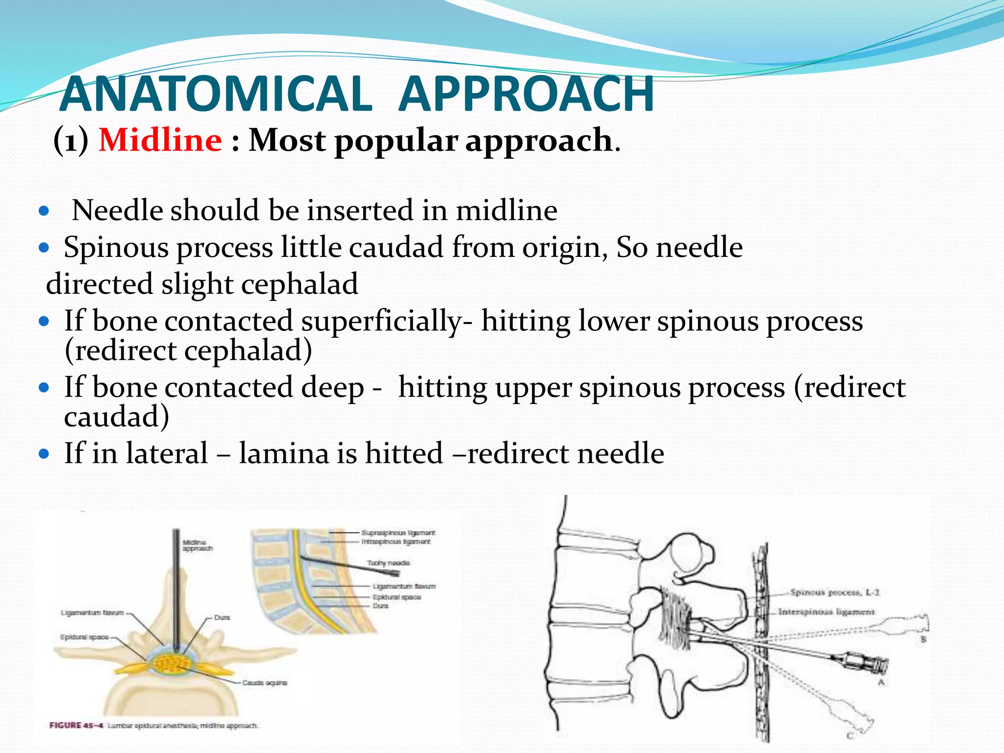 ANATOMICAL APPROACH
(1) Midline : Most popular approach.
 Needle should be inserted in midline
 Spinous process little caudad from origin, So needle
directed slight cephalad
 If bone contacted superficially- hitting lower spinous process
(redirect cephalad)
 If bone contacted deep - hitting upper spinous process (redirect
caudad)
 If in lateral – lamina is hitted –redirect needle
 