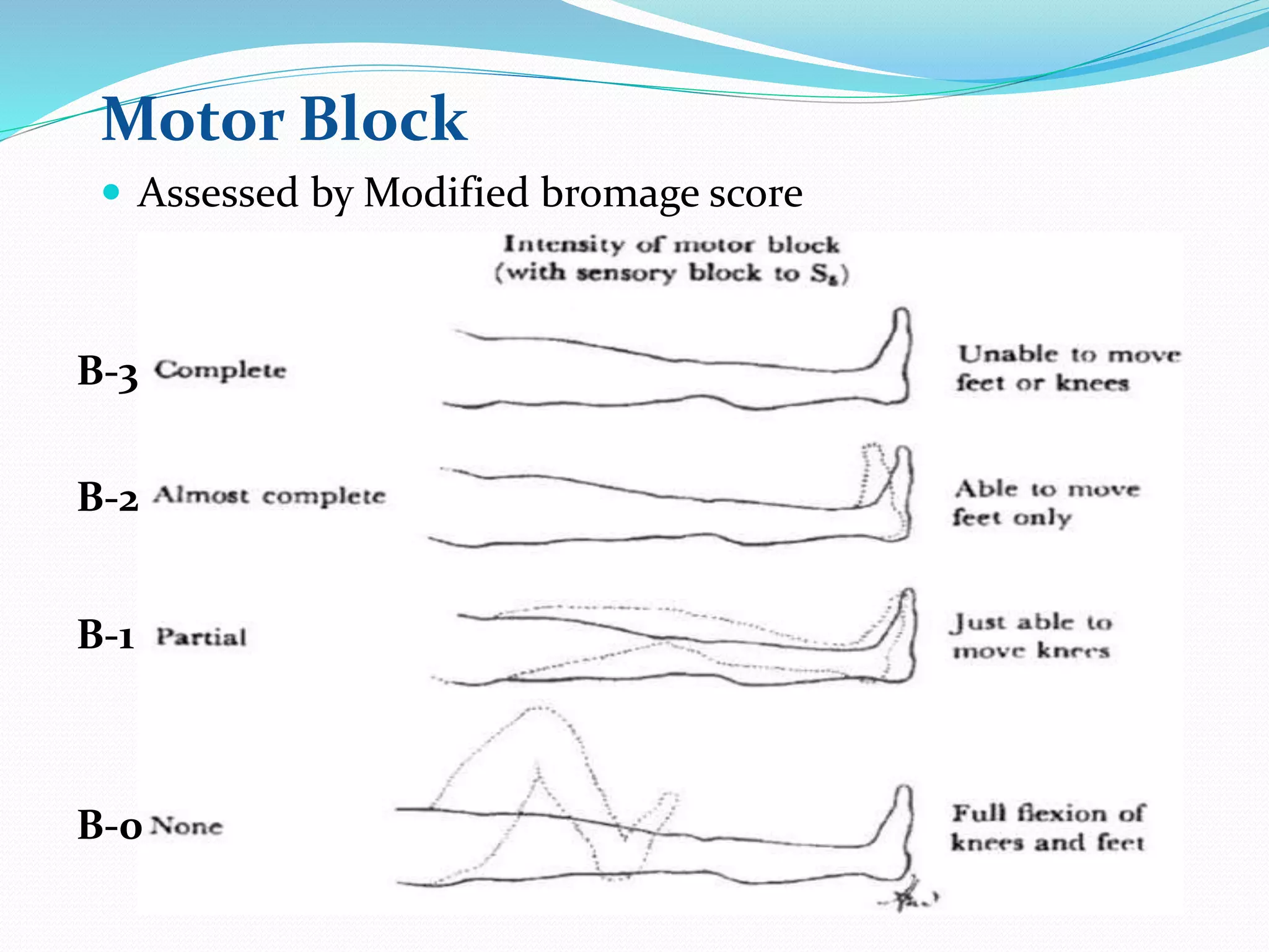 Motor Block
 Assessed by Modified bromage score
B-3
B-2
B-1
B-0
 
