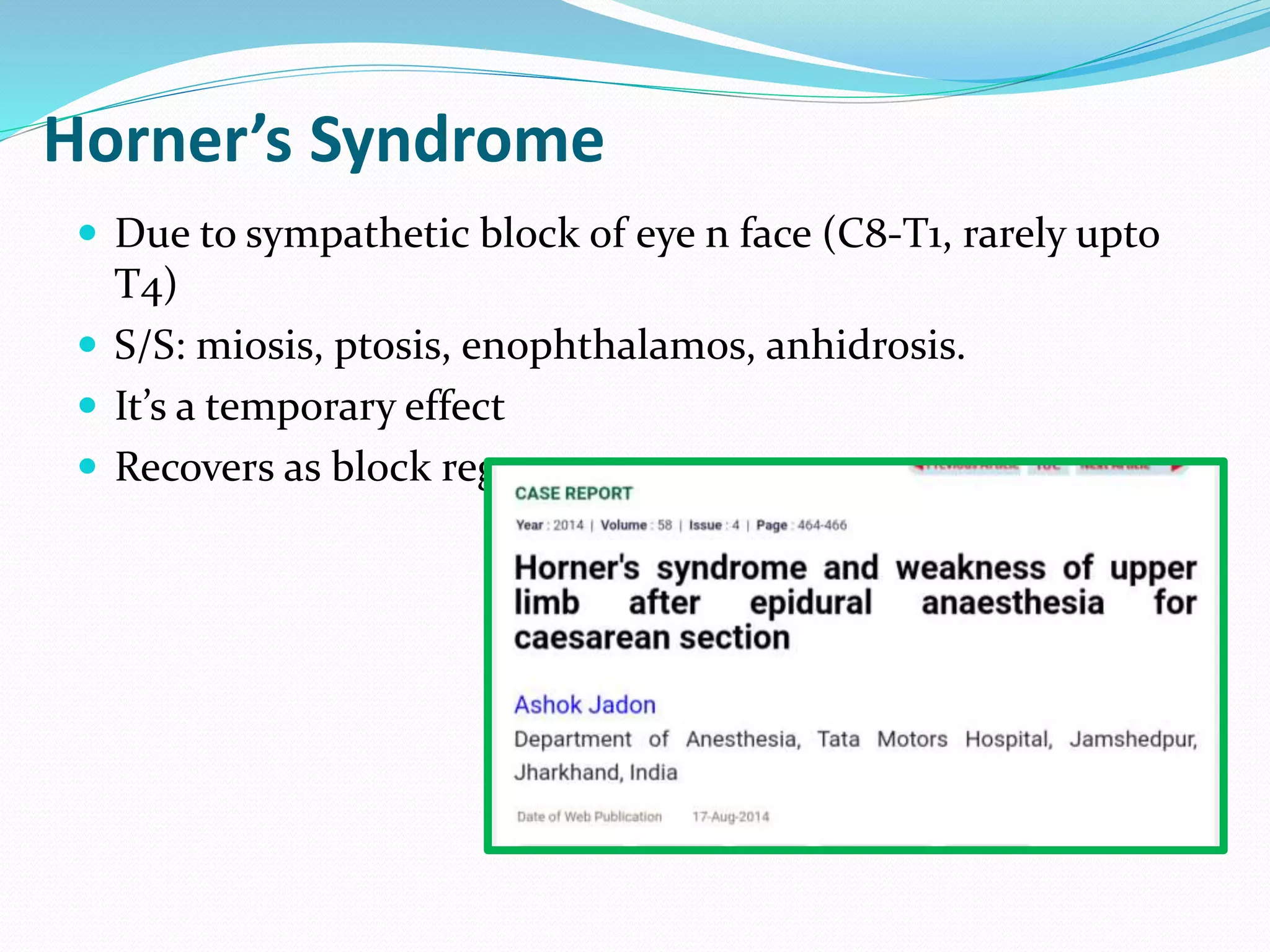Horner’s Syndrome
 Due to sympathetic block of eye n face (C8-T1, rarely upto
T4)
 S/S: miosis, ptosis, enophthalamos, anhidrosis.
 It’s a temporary effect
 Recovers as block regress.
 