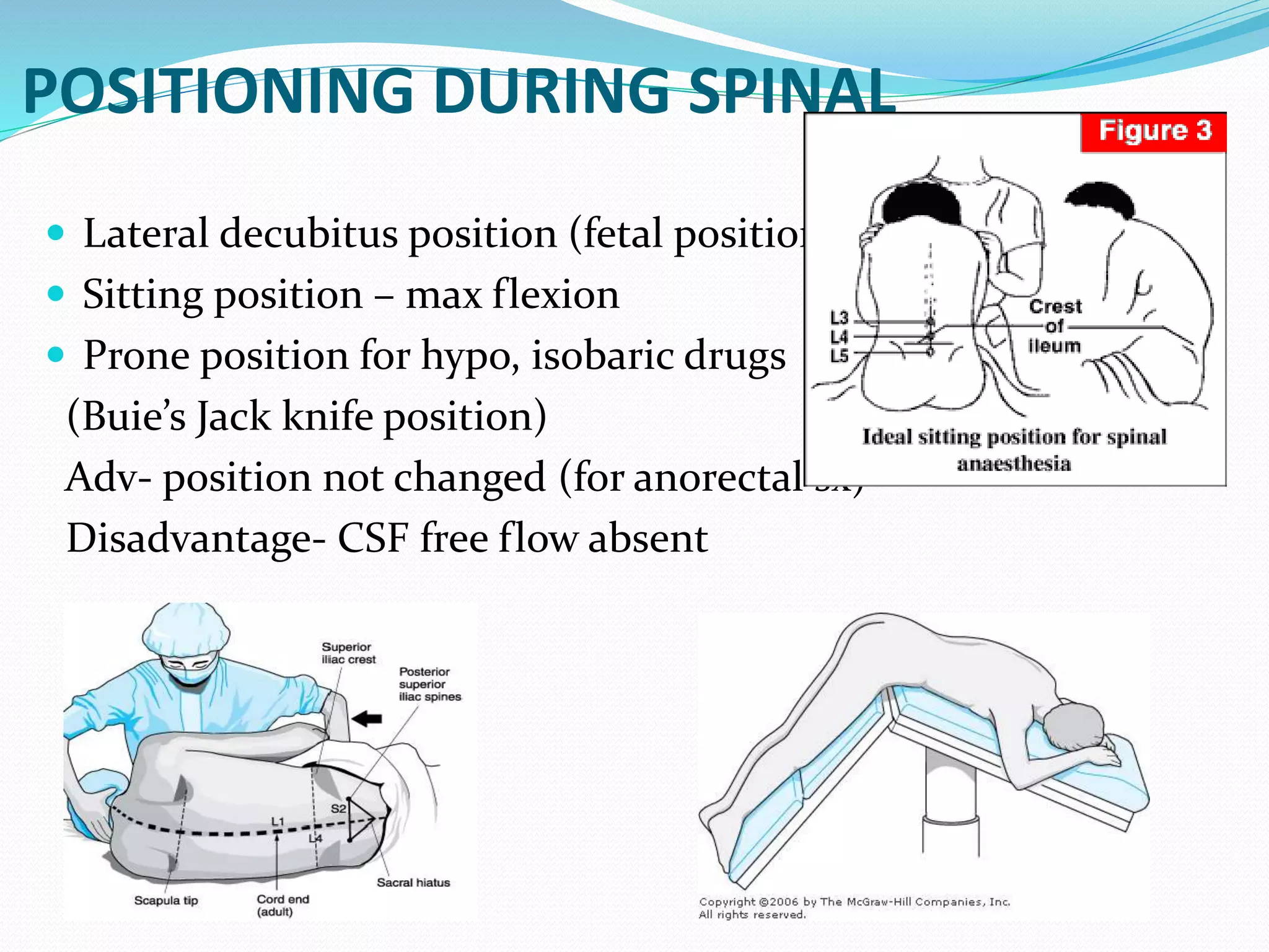 POSITIONING DURING SPINAL
 Lateral decubitus position (fetal position)
 Sitting position – max flexion
 Prone position for hypo, isobaric drugs
(Buie’s Jack knife position)
Adv- position not changed (for anorectal sx)
Disadvantage- CSF free flow absent
 
