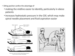  Sitting position confers the advantage of
making the midline easier to identify, particularly in obese
patients
increases hydrostatic pressure in the CSF, which may make
spinal needle placement and fluid aspiration easier
 