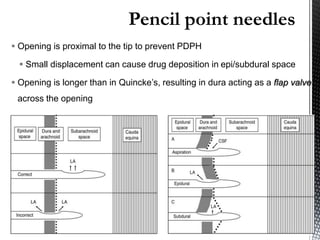  Opening is proximal to the tip to prevent PDPH
 Small displacement can cause drug deposition in epi/subdural space
 Opening is longer than in Quincke’s, resulting in dura acting as a flap valve
across the opening
 
