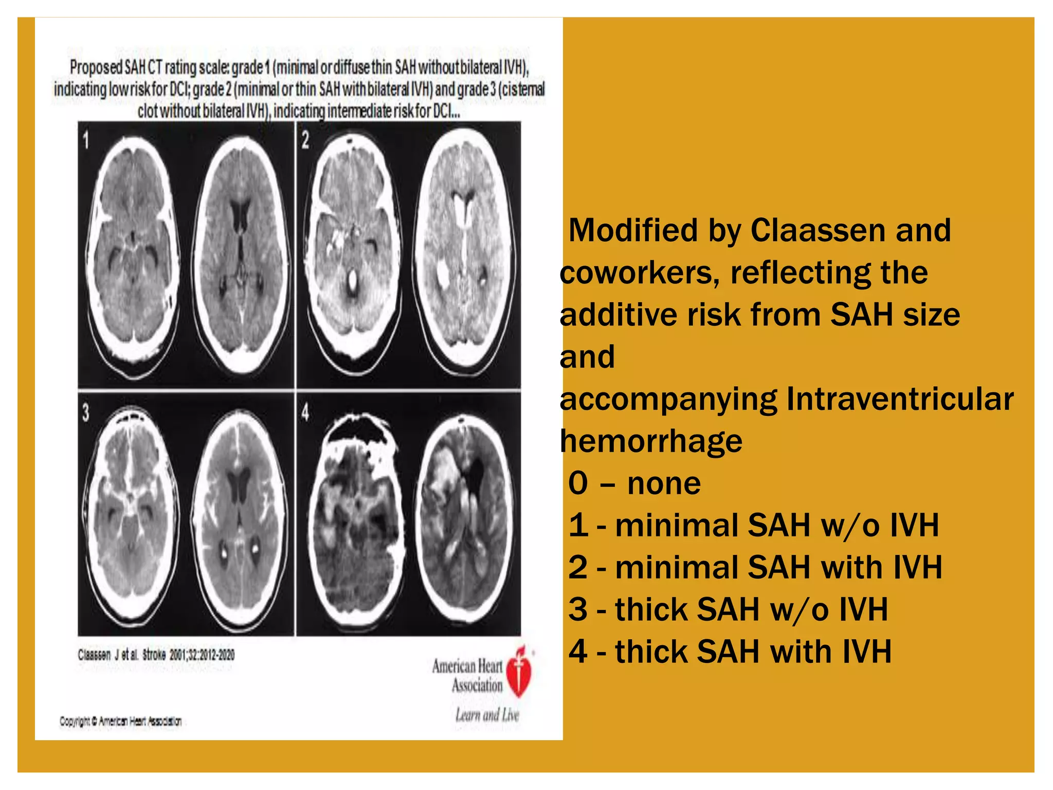 Subarachnoid hemorrage –eso guidelines for management | PPTX | Brain ...