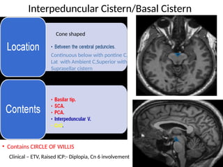 SUBARACHNOID SPACES - the CSF Cisterns.pptx