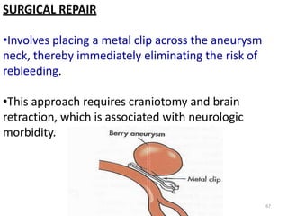 SURGICAL REPAIR
•Involves placing a metal clip across the aneurysm
neck, thereby immediately eliminating the risk of
rebleeding.
•This approach requires craniotomy and brain
retraction, which is associated with neurologic
morbidity.

67

 