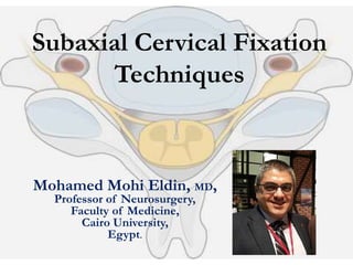 Subaxial Cervical Fixation
Techniques
Mohamed Mohi Eldin, MD,
Professor of Neurosurgery,
Faculty of Medicine,
Cairo University,
Egypt.
 