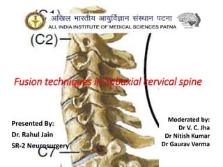 Fusion techniques in Subaxial cervical spine
Presented By:
Dr. Rahul Jain
SR-2 Neurosurgery
Moderated by:
Dr V. C. Jha
Dr Nitish Kumar
Dr Gaurav Verma
 