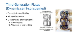 Third-Generation Plates
(Dynamic semi-constrained)
• Prevent stress shielding
• Allow subsidence
• Mechanisms of dynamism :
1. screw toggling
2. Allowance of axial settling
 