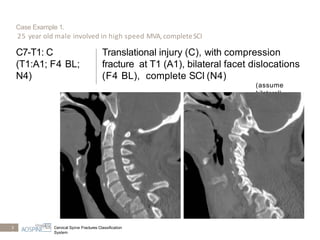Subaxial spine (2) | PPTX