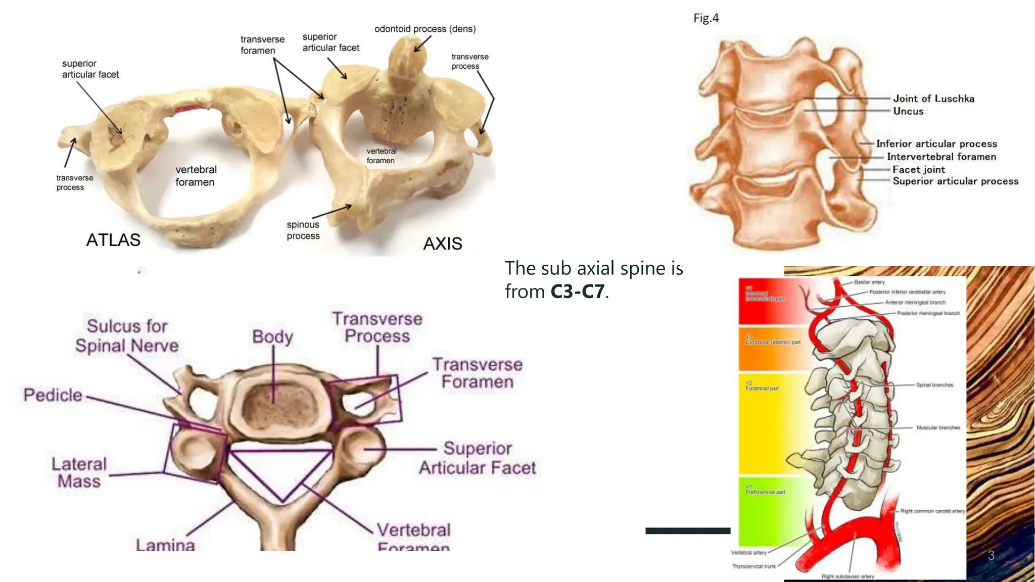 SUBAXIAL SPINE INJURY BY DR NKUNDIMANA JEAN PAUL .pptx