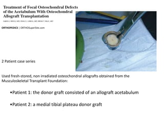 ORTHOPEDICS | ORTHOSuperSite.com
2 Patient case series
Used fresh-stored, non irradiated osteochondral allografts obtained from the
Musculoskeletal Transplant Foundation:
•Patient 1: the donor graft consisted of an allograft acetabulum
•Patient 2: a medial tibial plateau donor graft
 