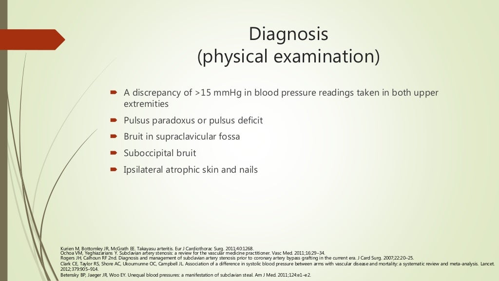 Subclavian Steal Syndrome Symptoms Causes Treatment A vrogue.co