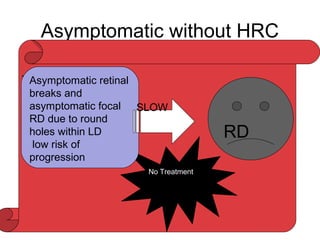 Asymptomatic without HRC
• Retinal breaks
• Autopsy studies
-break due to VR traction -3%
-break without VR traction-4%
• Clinical Studies
-14%-Rutnin and Schepens(102 pt)
-3.3%-Byer(3400 Eyes)
• No RD in 231eyes with asymptomatic breaks-Byer
• Neumann etal-asymptomatic retinal break:RD=218:1
- -
No Treatment
Asymptomatic retinal
breaks and
asymptomatic focal
RD due to round
holes within LD
low risk of
progression
RD
SLOW
 