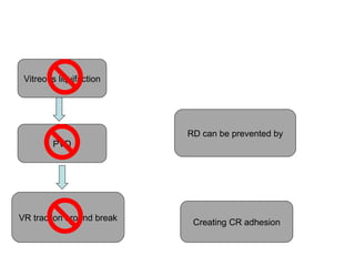 Vitreous liquifaction
VR traction around break
PVD
RD can be prevented by
Creating CR adhesion
 