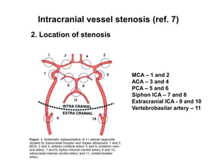 Intracranial vessel stenosis (ref. 7)3. Measurement of stenosis