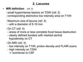 2. LacunesMRI definition(ref. 2): small hyperintense lesions on T2WI (ref. 2): corresponding distinctive low intensity area on T1WI: Maximum size of lacune (ref. 4)  - with a diameter of 5-10 mm: On CT (ref. 4)  - areas of more or less complete focal tissue destruction  - clearly defined borders with marked central hypodensity on CT: On MRI (ref. 4)  - low intensity on T1WI, proton-density and FLAIR scans  - high intensity on T2WI    -> isointense to CSF