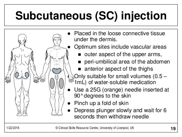 subcutaneous injection technique subcutaneous injection needle size